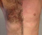 Chest_waxing_cropped