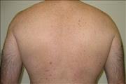back-waxing-4-weeks